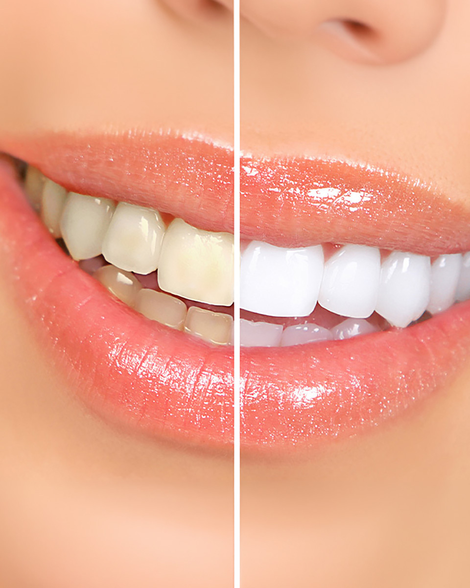 Dental hospital in Dilsukhnagar