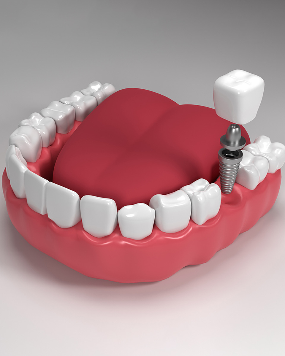 Dental Services in Kothapet